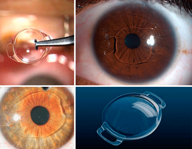 A cirurgia