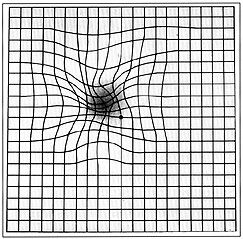 GradedeAmsler com DMRI