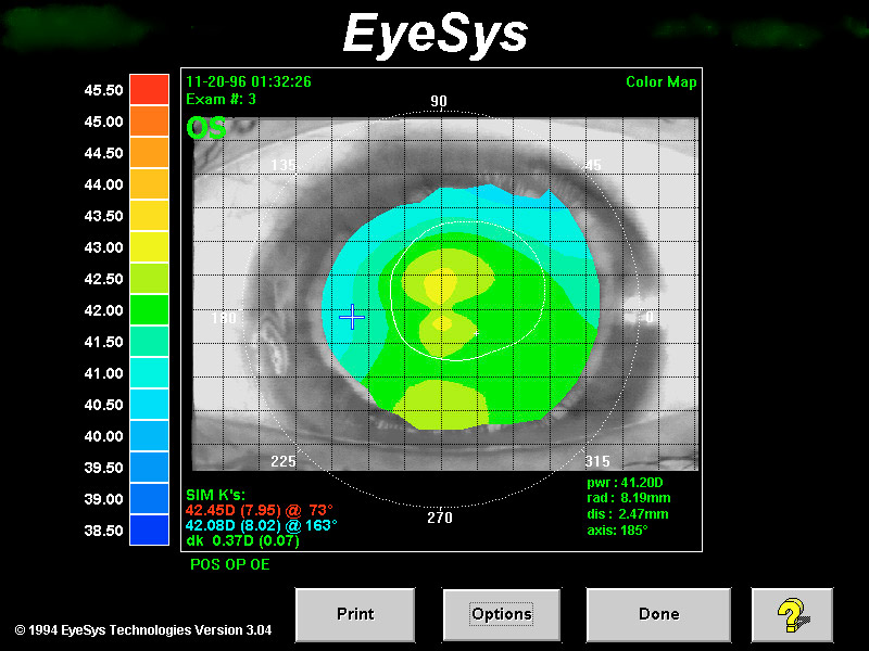 Topografia Eye Sys